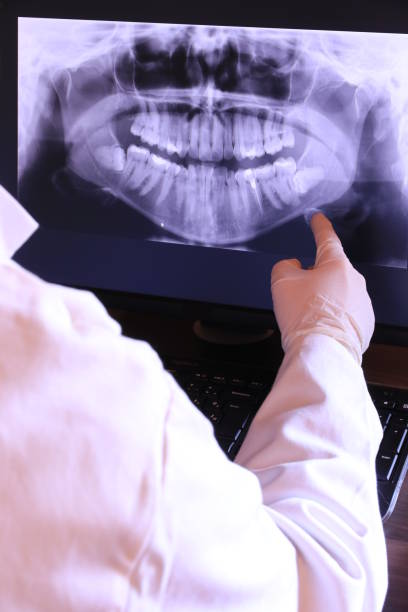 Best Emergency Wisdom Teeth Removal in Crivitz, WI
