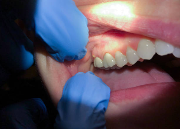 Best Weekend Emergency Dentist in Crivitz, WI